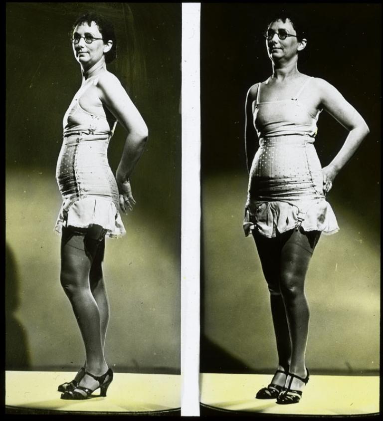 Woman wearing girdle and glasses  National Film and Sound Archive of  Australia