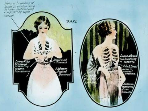 Slide shows diagrams of two women, one wearing a corset and one wearing Berlei foundation garment. The text talks about lung function.
