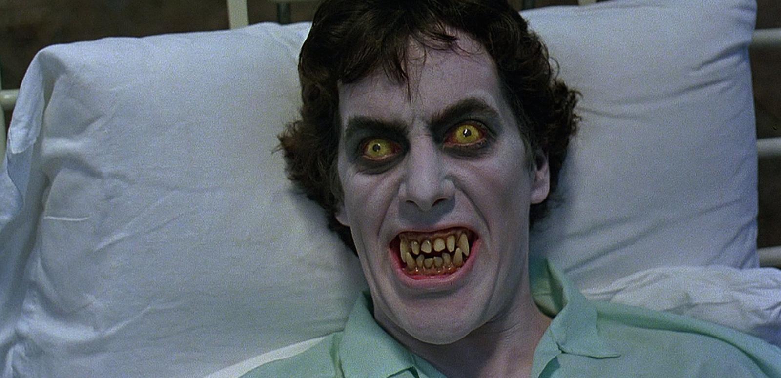 Close up of a man in a hospital bed with yellow eyes and big teeth who looks like he is turning into a monster.