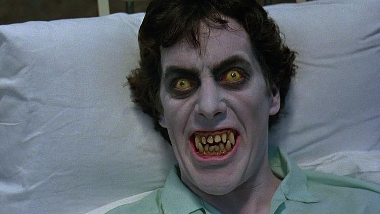 Close up of a man in a hospital bed with yellow eyes and big teeth who looks like he is turning into a monster.